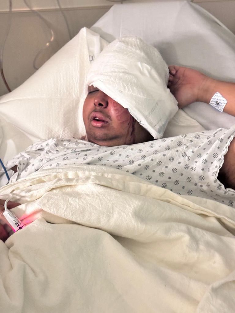 The cop, who was not immediately identified, suffered a fractured eye socket after being kicked in the head while lying on the floor, sources said.
