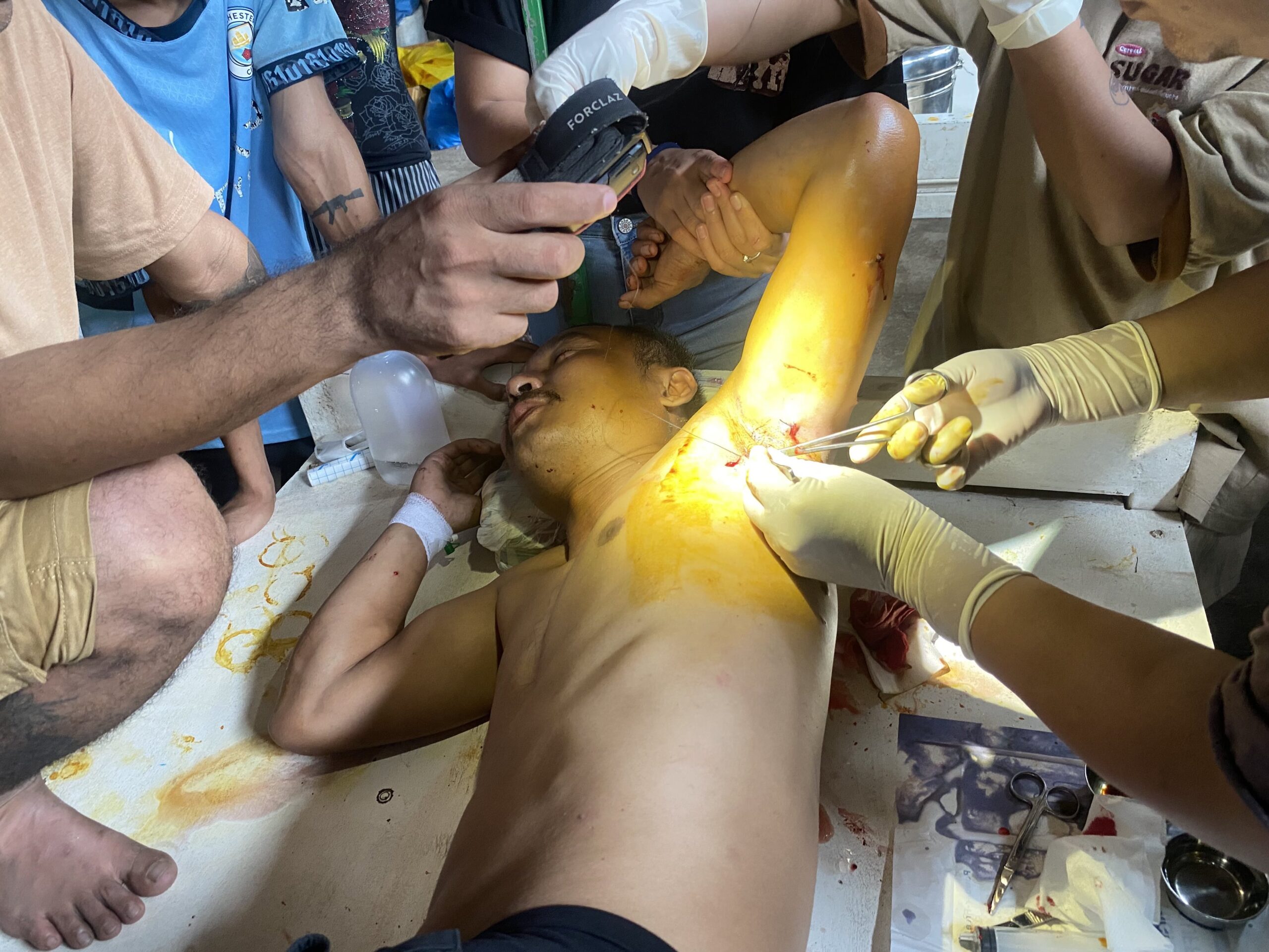 Medical personnel performing a surgical procedure on a patient with visible wounds and tools in a clinical setting.